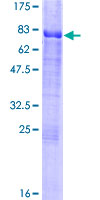 12.5% SDS-PAGE Stained with Coomassie Blue.